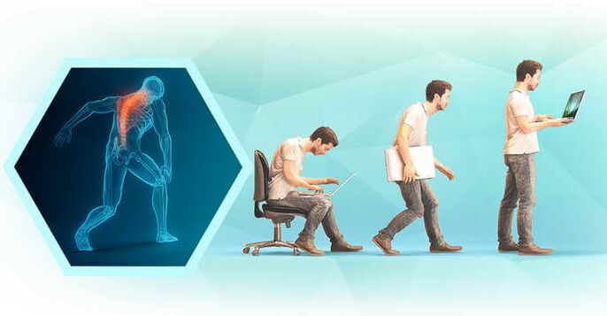 cattiva postura quando si lavora al computer e osteocondrosi toracica