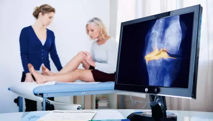 Artrosi dell'articolazione in una donna